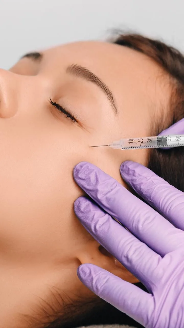 PRP Skin Rejuvenation